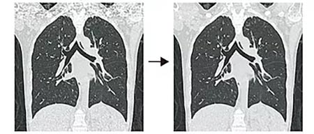ノイズ発生が軽減された高精細な画像